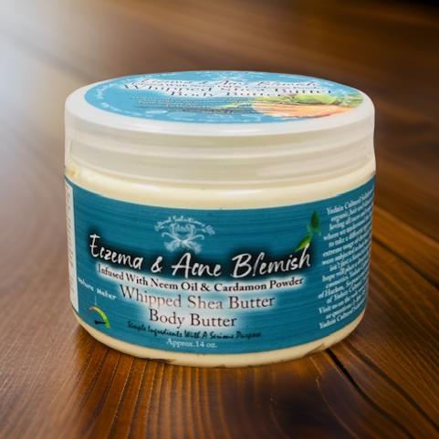 Eczema & Acne Blemish Whipped Shea Butter Body Butter